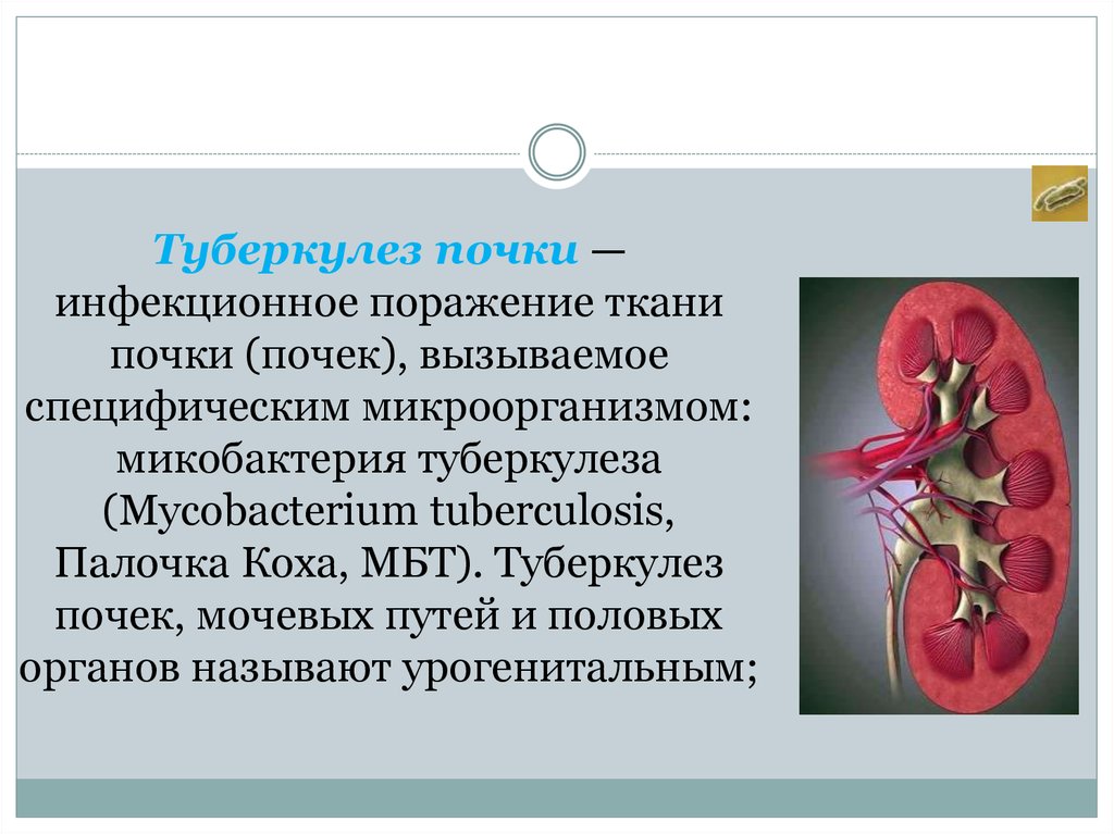 Поражаемые органы туберкулеза. Туберкулезное поражение почек. Критерии заболевания туберкулезом почки. Туберкулёз почек и мочевыводящих путей. Туберкулёз мочевыделительной системы.