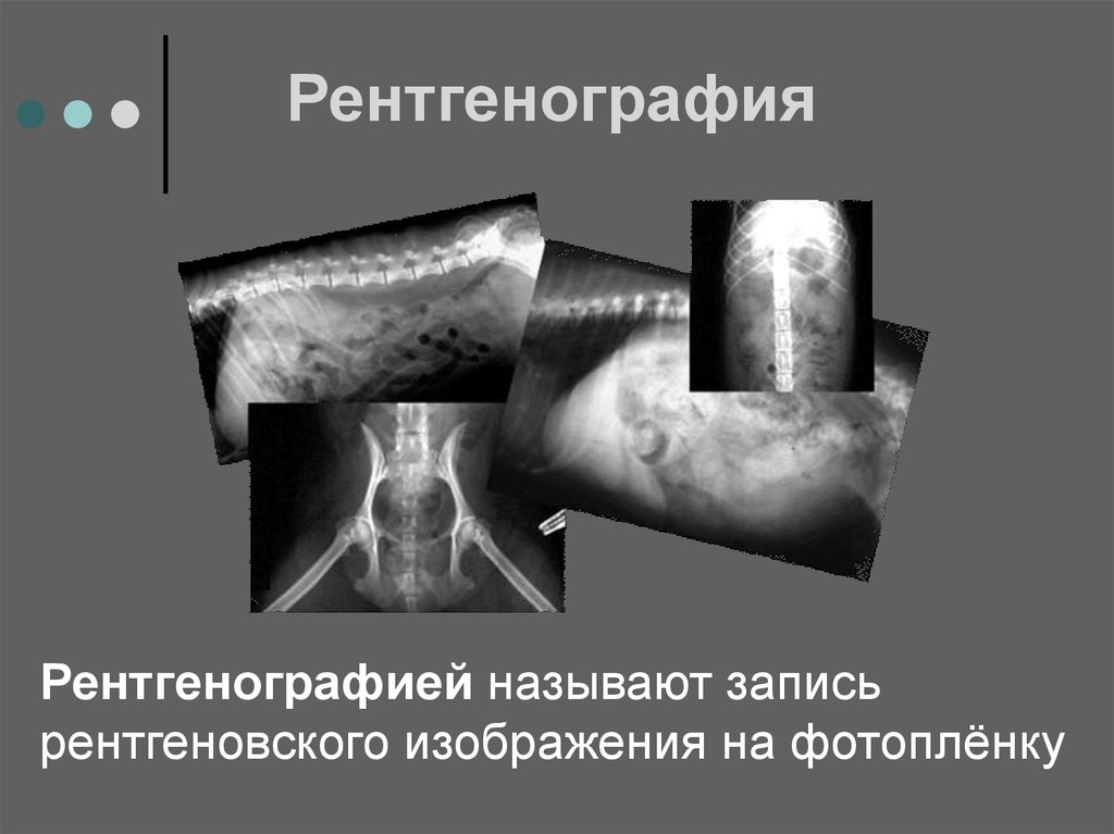 Рентгенография с прямым увеличением изображения применяется