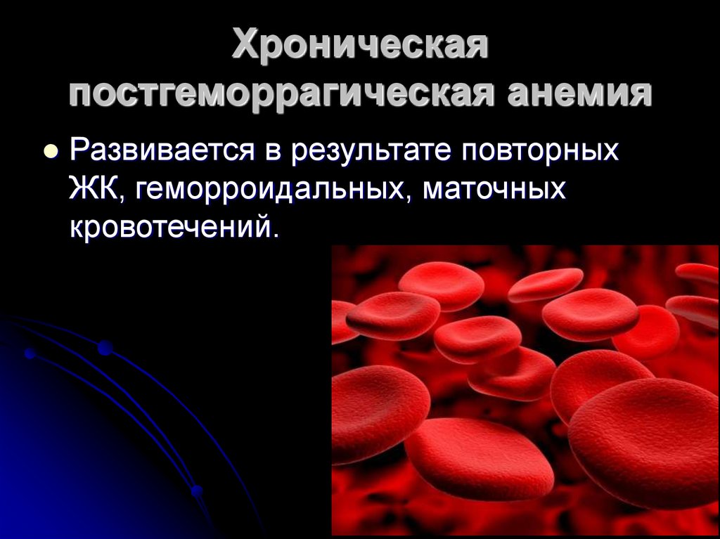 Что за болезнь анемия. Хроническая постгеморрагическая анемия. Хроническая постгеморрагическая анемия этиология. Хронические постгеморрагические анемии лабораторно. Острая постгеморрагическая анемия клиника.