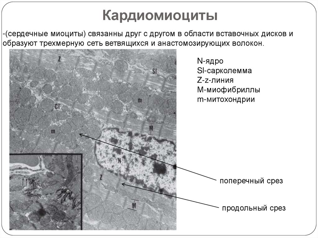 Атипичные кардиомиоциты рисунок