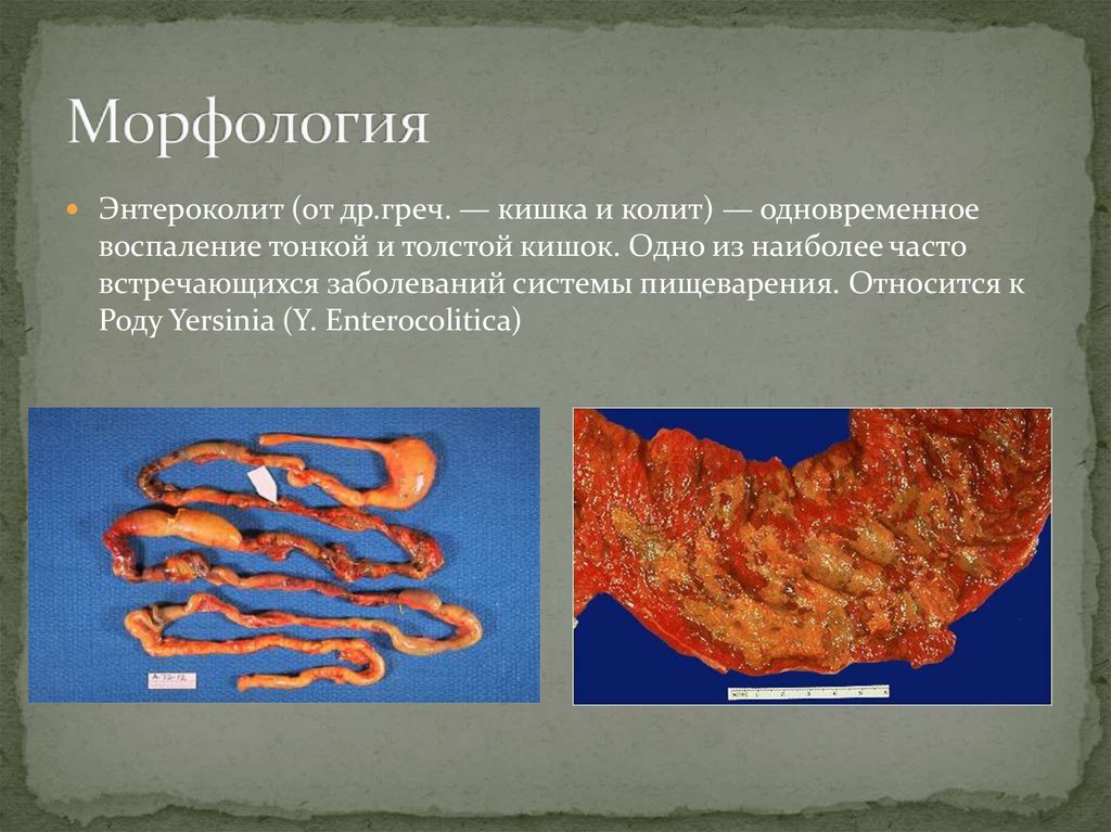 Морфология