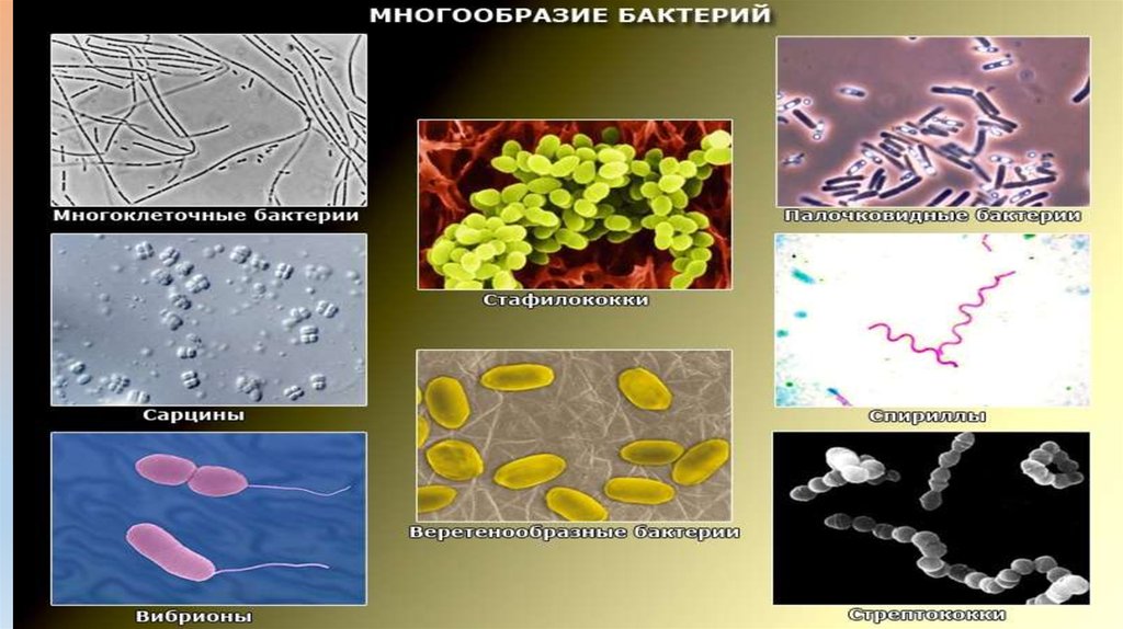 Большинство бактерий можно увидеть. Многообразие бактерий. Разнообразие микроорганизмов. Разнообразие бактерий по форме. Бета разнообразие микроорганизмов.