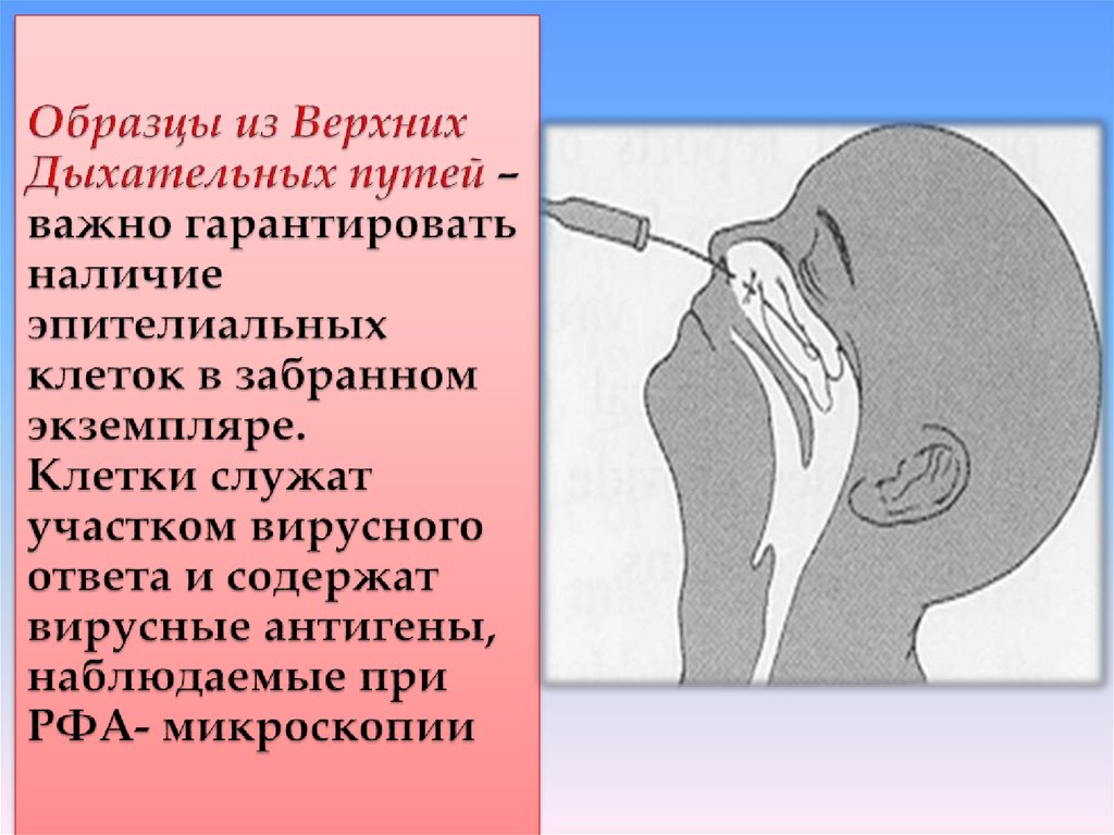 Образцы из Верхних Дыхательных путей – важно гарантировать наличие эпителиальных клеток в забранном экземпляре. Клетки служат