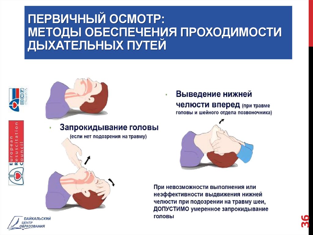 Как обеспечить восстановление проходимости. Приемы восстановления проходимости дыхательных путей. Обеспечение проходимости дыхательных путей алгоритм. Восстановление проходимости дыхательных путей у пострадавшего. Положение головы для обеспечения проходимости дыхательных путей.