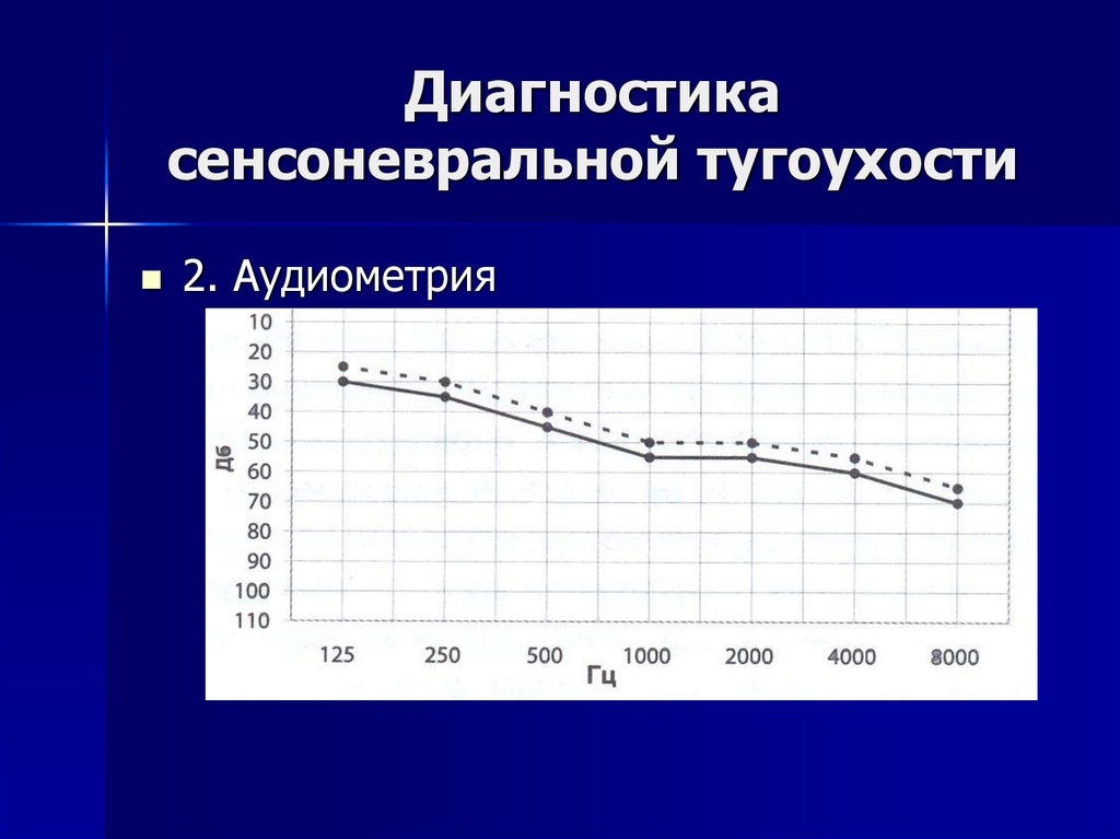 Сенсоневральная тугоухость презентация