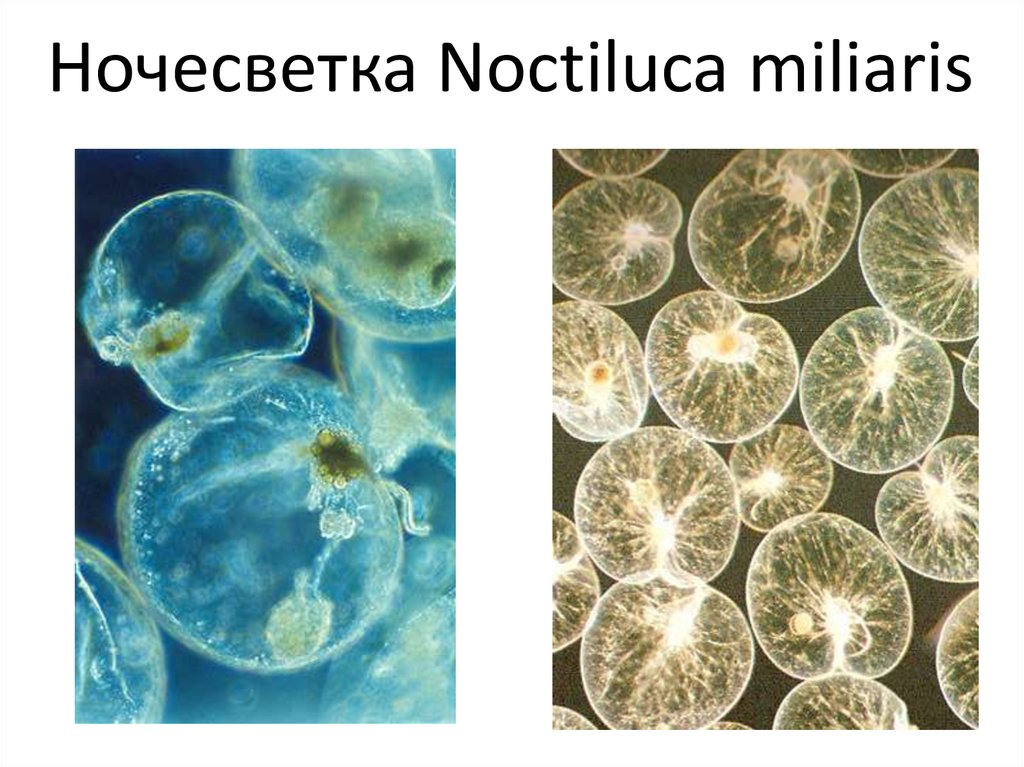 Простейшие вызывают воды. Водоросль ночесветка черное море. Ночесветка Noctiluca. Noctiluca miliaris. Жгутиконосные водоросли ночесветки.