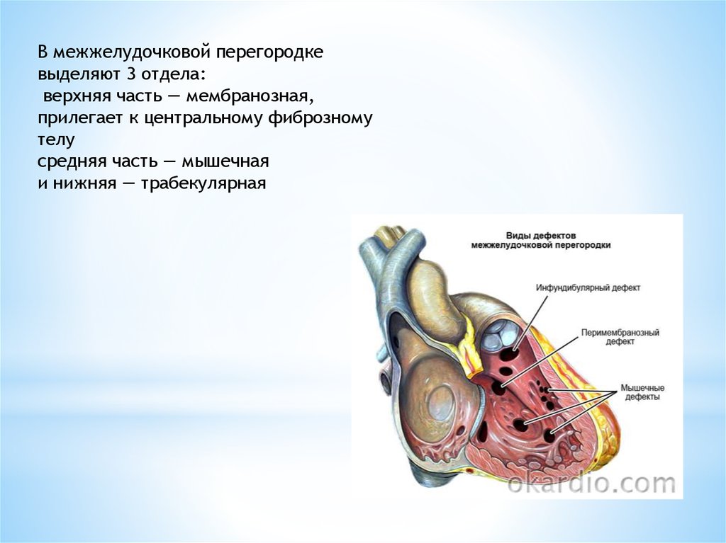 Межжелудочковая перегородка. Мембранозный дефект межжелудочковой перегородки. Мембранозная часть межжелудочковой перегородки. Мембранозная часть межжелудочковой перегородки анатомия. Строение межжелудочковой перегородки.