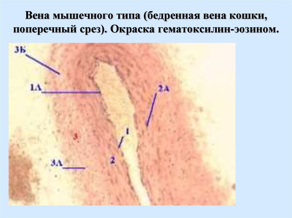 Типа вена. Бедренная Вена препарат. Препарат мышечного типа бедренная Вена препарат. Вена мышечного типа бедренная Вена. Бедренная Вена кошки гистология.