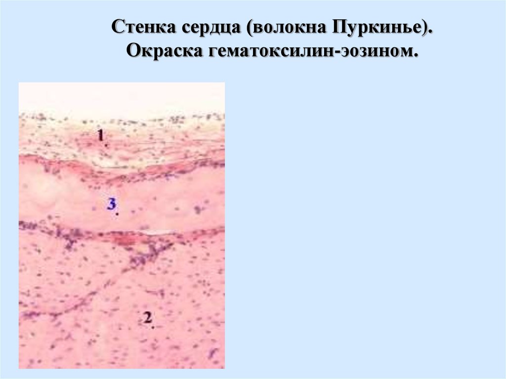 Срез стенки сердца рисунок