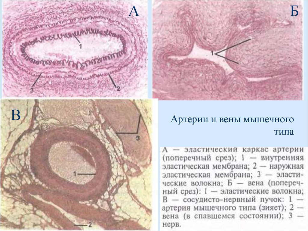 Мышцы артерий. Препарат артерия и Вена мышечного типа. Стенка артерии и вены мышечного типа импрегнация серебром. Вена мышечного типа препарат гистология. Вена эластического и мышечного типа.