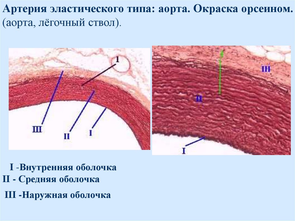 Артерии мышечно эластического типа