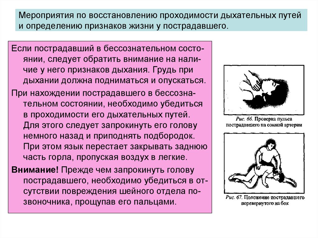 При определении жизни у пострадавшего проверяются. Мероприятия по определению признаков жизни у пострадавшего. Мероприятия по проходимости дыхательных путей. Мероприятия для восстановления проходимости дыхательных путей. Методика восстановления дыхательных путей.