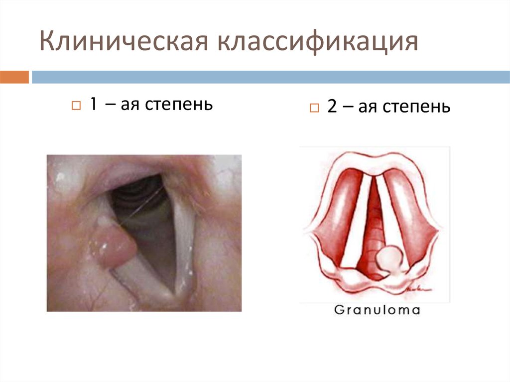 Клиническая классификация