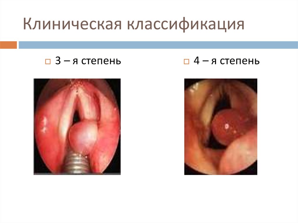 Клиническая классификация