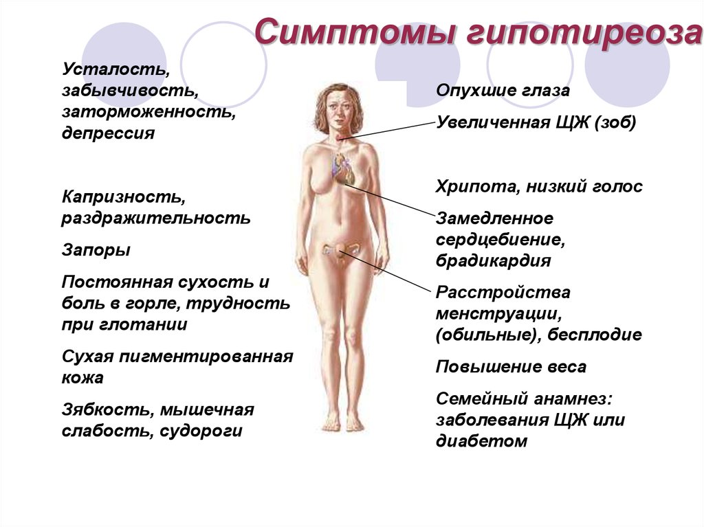 Гипотиреоз форум женщин. Симптомы гипотеризоза. Гипотиреоз симптомы симптомы. Основные клинические симптомы гипотиреоза.