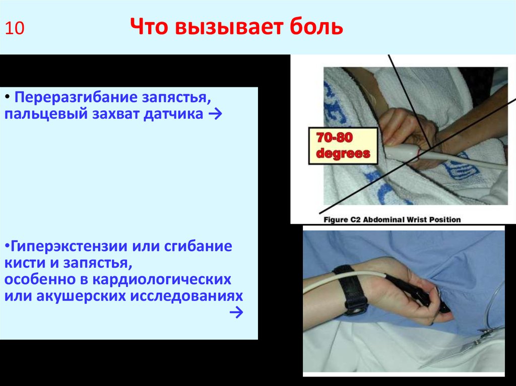 10 Что вызывает боль