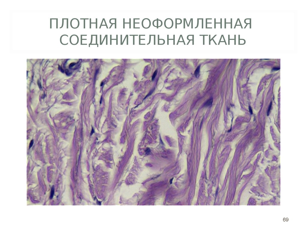 Плотная волокнистая неоформленная соединительная ткань рисунок