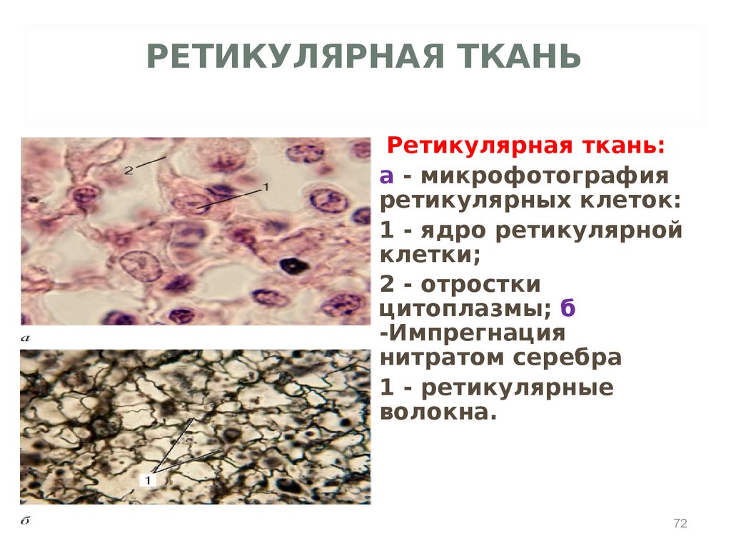 Отростки ткани. Ретикулярная ткань это соединительная ткань. Ретикулярная соединительная ткань функции. Ретикулярная соединительная ткань строение. Радикулярная соединительная ткань.