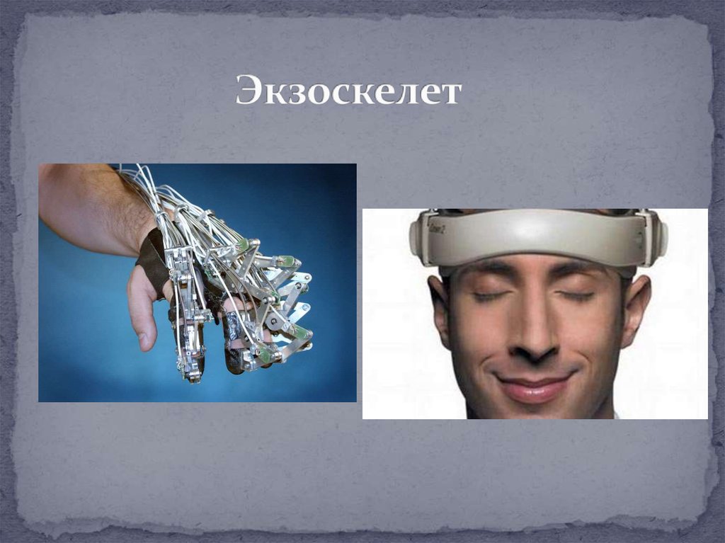 Экзоскелет