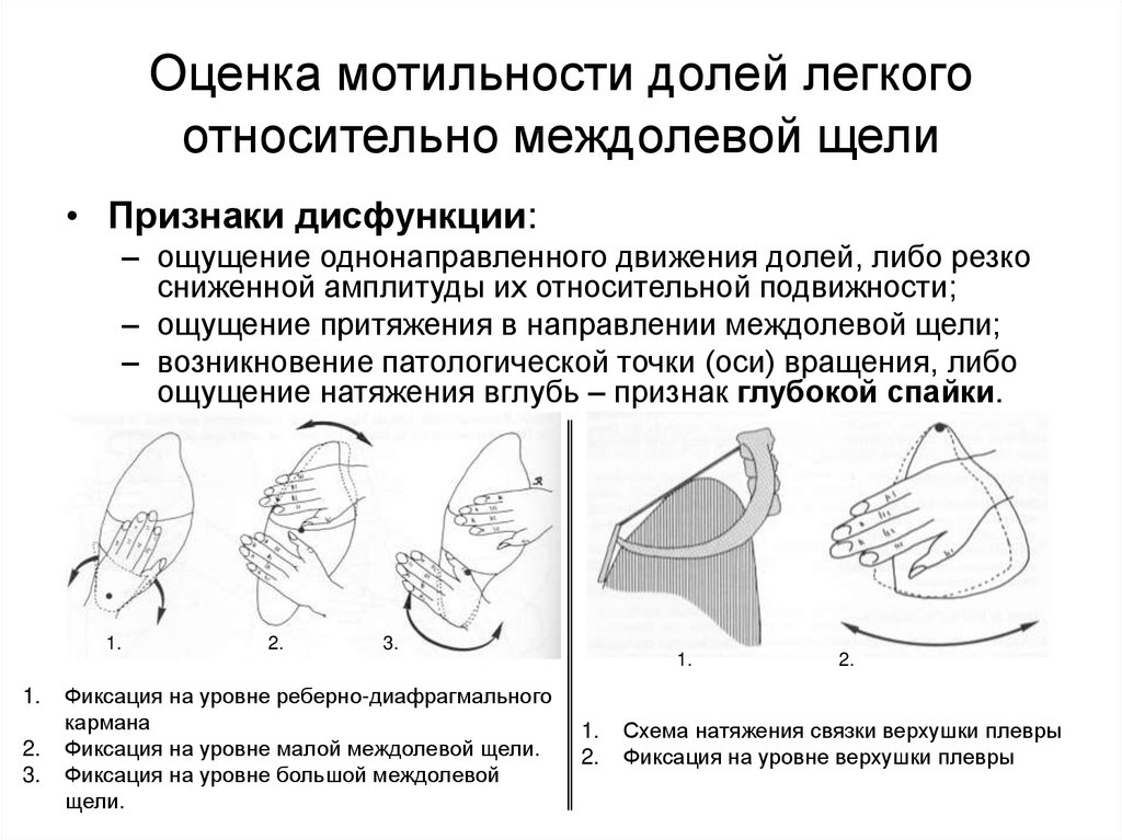 Плевра у женщин