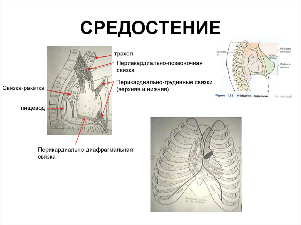 Образования средостения схема