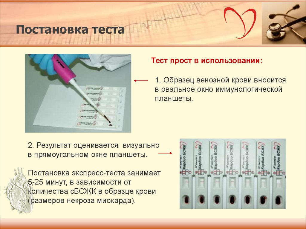 Тест занимает. Тест при инфаркте. Тест для диагностики инфаркта миокарда. Экспресс тест на инфаркт миокарда. Экспресс тесты маркеры инфаркта миокарда.