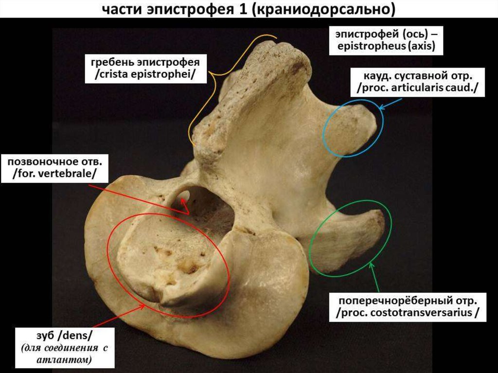 Гребни на латинском. Гребень позвонка. Гребень эпистрофея. Вентральный гребень позвонка. Вентральный гребень позвонка животного.