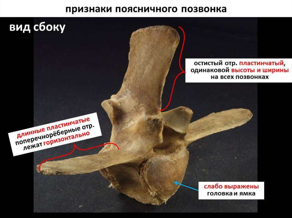 Остистые отростки позвоночника фото