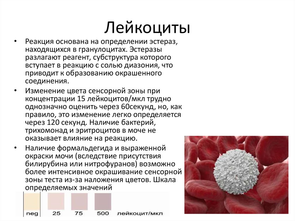 Лейкоциты. Окрашивание лейкоцитов. Краткая характеристика лейкоцитов. Морфологическая характеристика лейкоцитов.