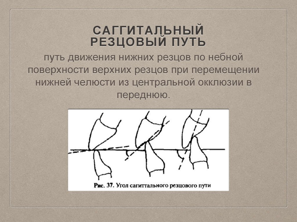 Резцовый. Трансверзальный резцовый путь. Угол сагиттального суставного и резцового пути. Сагиттальный резцовый путь. Угол резцового пути.