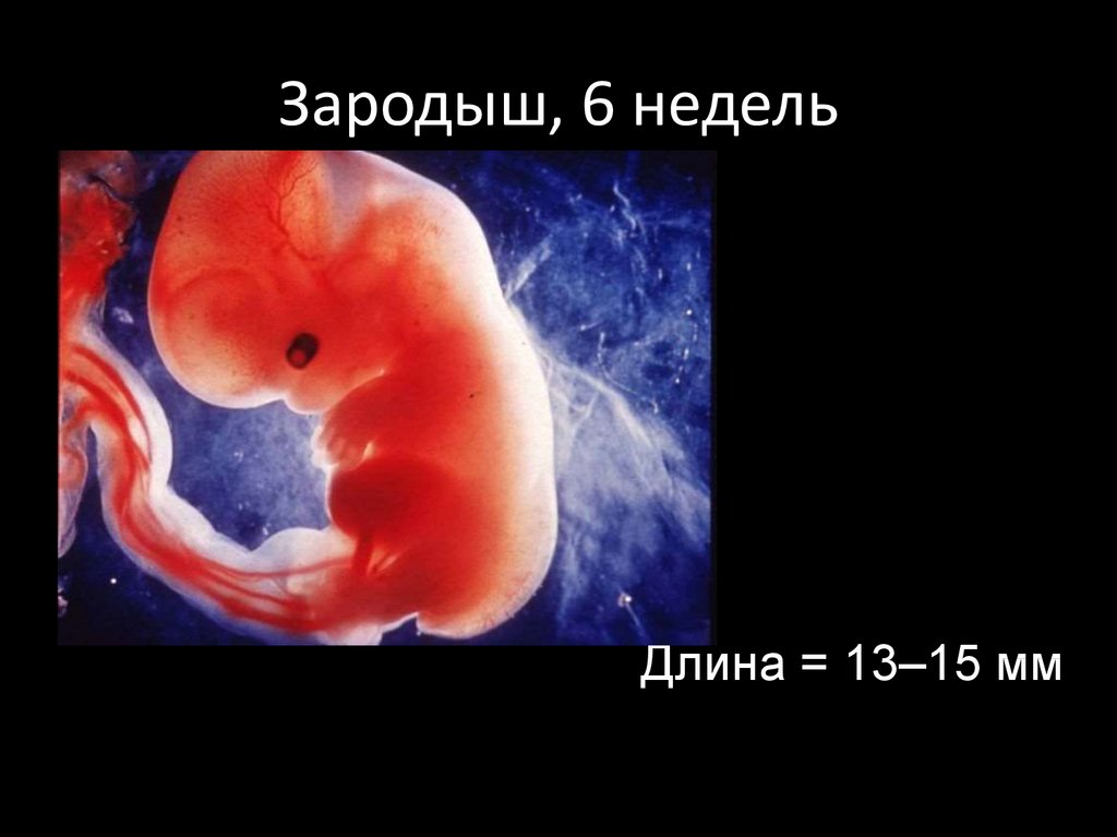 Фото эмбриона на 6 неделе беременности фото