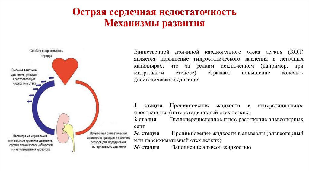 Острая сердечная недостаточность тема