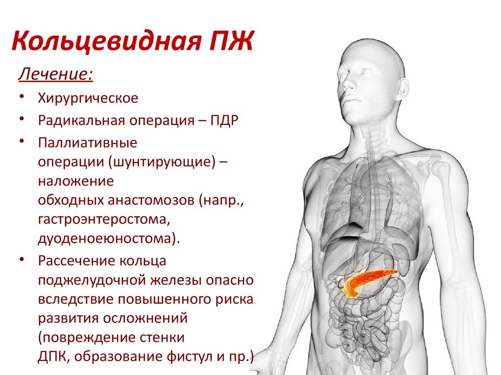 Высыпания при поджелудочной железе. Кольцевидная панкреас. Кольцевидная поджелудочная железа у детей. Аннулярная поджелудочная железа. Кольцевидная поджелудочная железа операция.