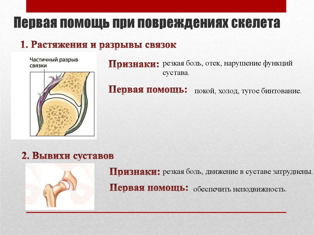 Какой вид травмы показан на рисунке какие кости повреждены