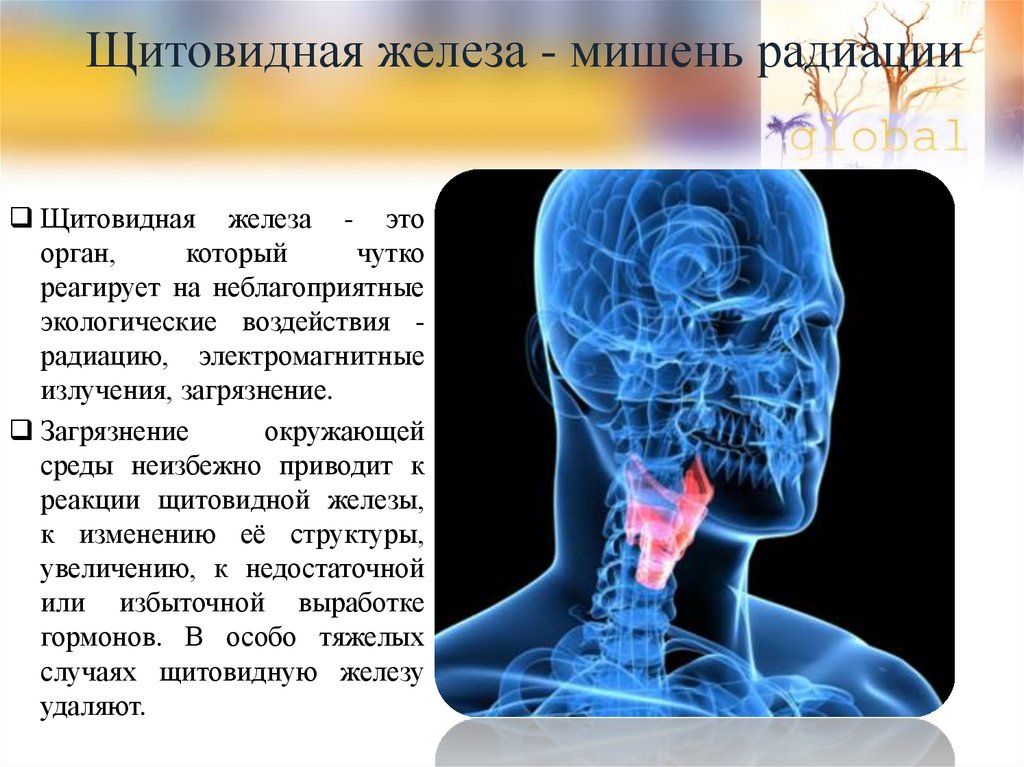 Щитовидная железа - мишень радиации
