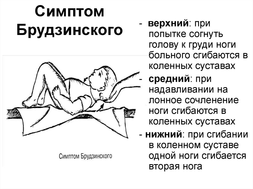 Почему засыпает нога. Верхний симптом Брудзинского. Симптом Брудзинского при инсульте. Симптом запрокидывания головы.