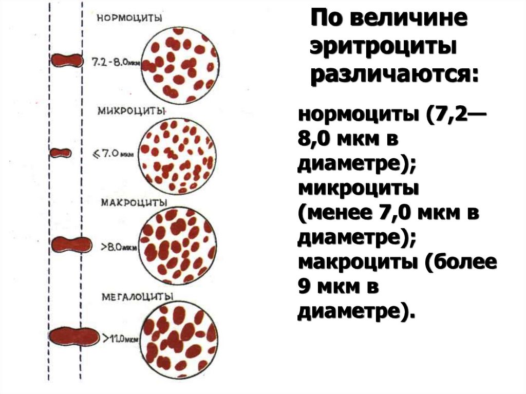 Нормоцит это. Нормоциты. Эритроциты нормоциты. Нормоциты микроциты макроциты мегалоциты. Изменение формы и размеров эритроцитов.