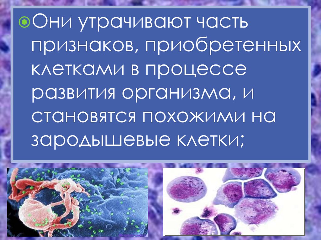 Признаки приобретенные организмом. Симптомы инфекции зародышевой клетки. Клеточный приобретенный. Опухоль из зародышевой клетки название.