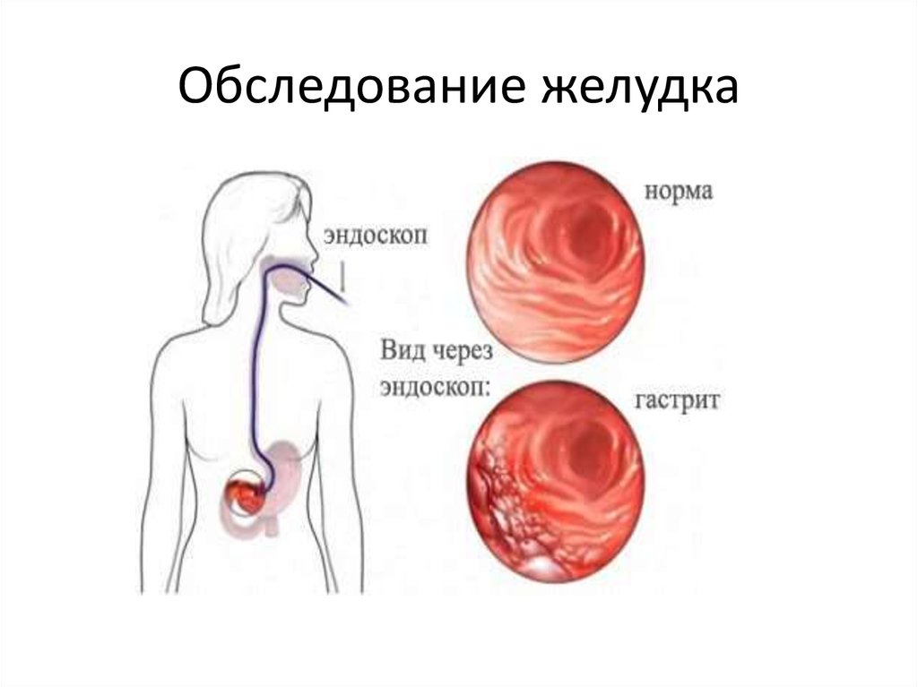 Обследование желудка. Обследование ЖКТ норма. Симптомы гастрита телесный.