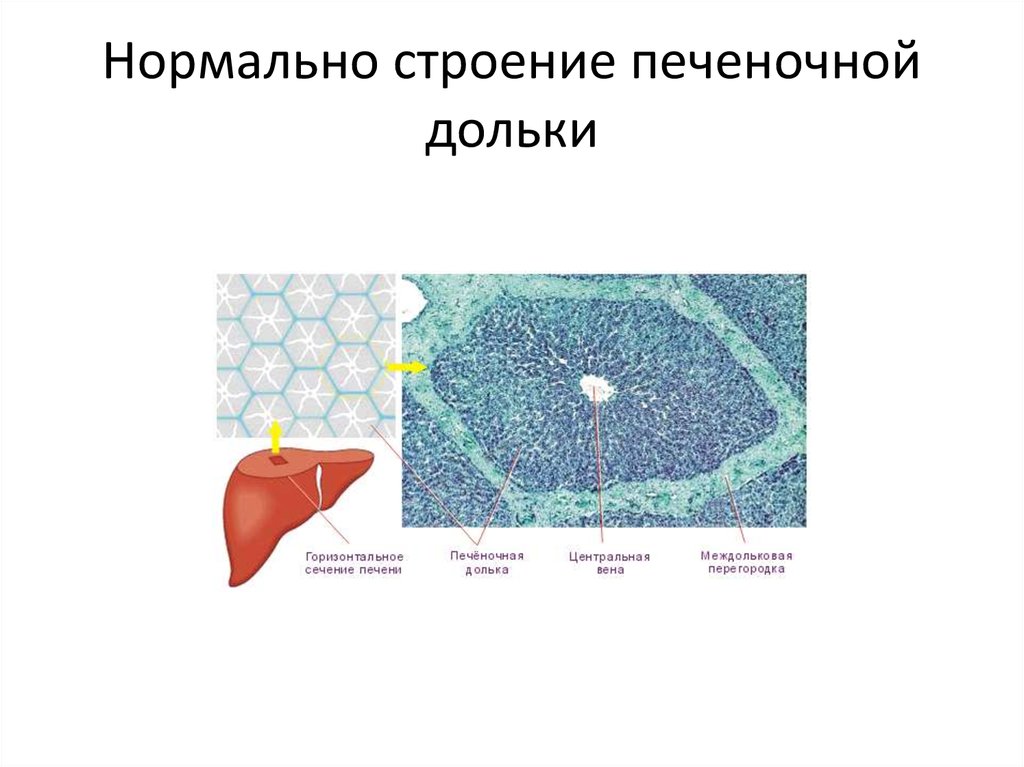 Нормальное строение. Междольковая Вена печени. Строение печеночной дольки. Центральная Вена печени. Строение печеночной дольки рисунок.