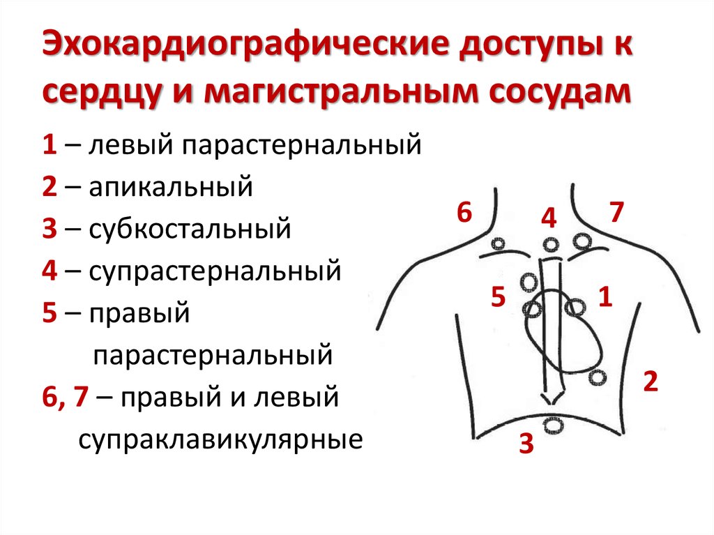 Магистральные сосуды это