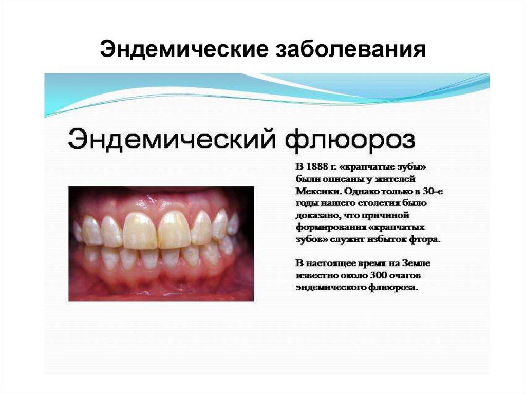 Для полости рта характерно. Флюороз зубов (эндемический флюороз зубов) —. Эндемические заболевания флюороз. Меловидно крапчатый флюороз. Меловидно крапчатая форма флюороза.