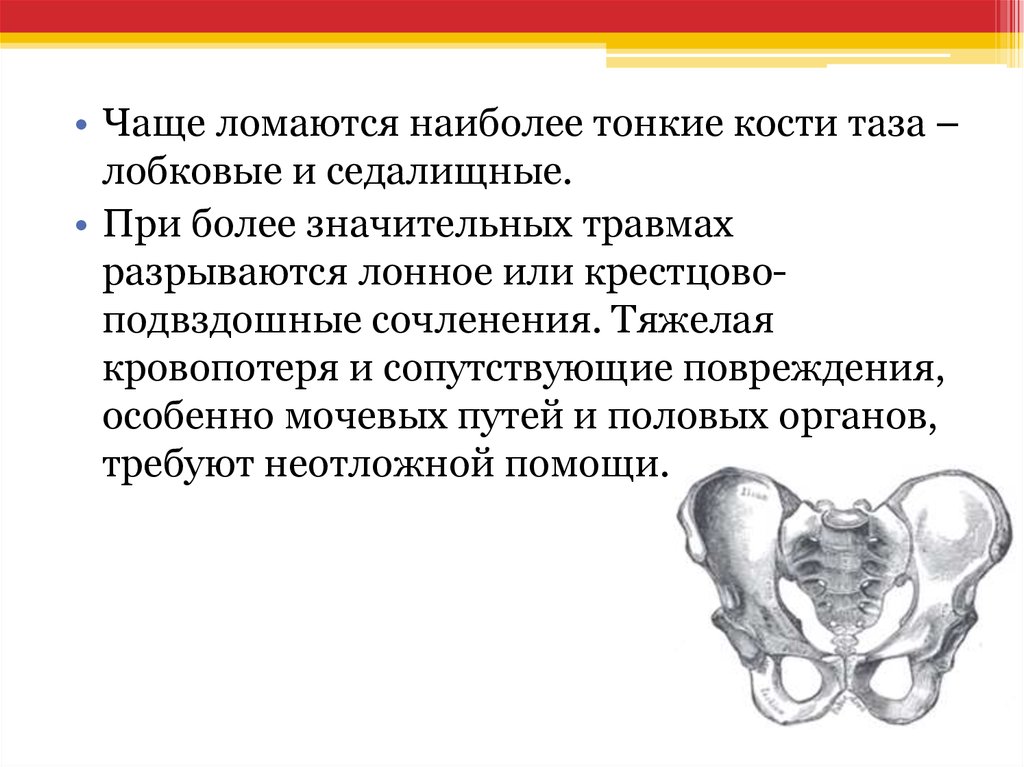 Изменения костей таза. Перелом лонной и седалищной костей таза. Перелом лонных костей таза. Перелом лонного сочленения таза.