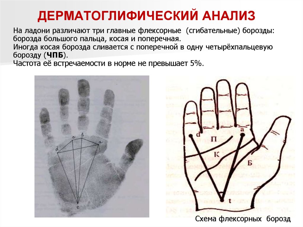 Дерматоглифический метод генетики презентация