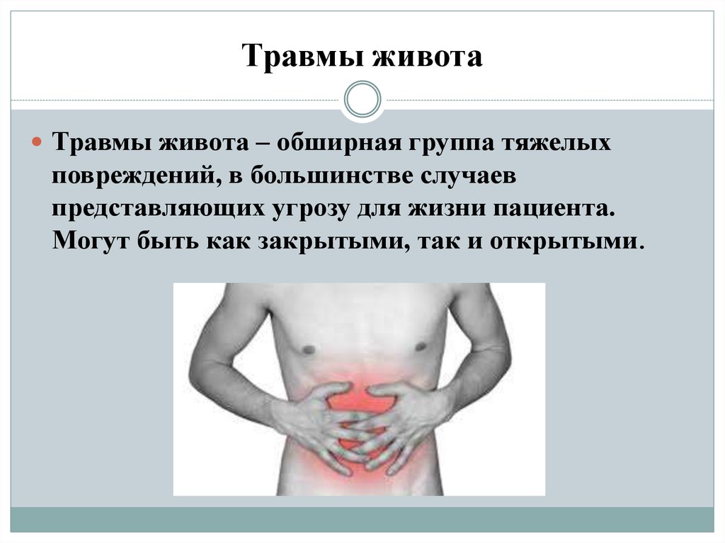 Боли брюшной. Закрытая травма живота. Закрытая тупая травма живота.