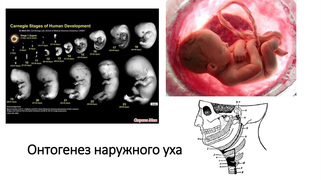 Онтогенез наружного уха