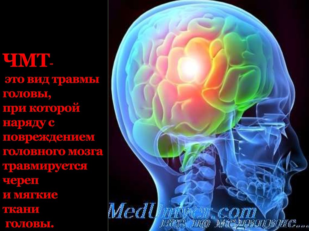 ЧМТ- это вид травмы головы, при которой наряду с повреждением головного мозга травмируется череп и мягкие ткани головы.
