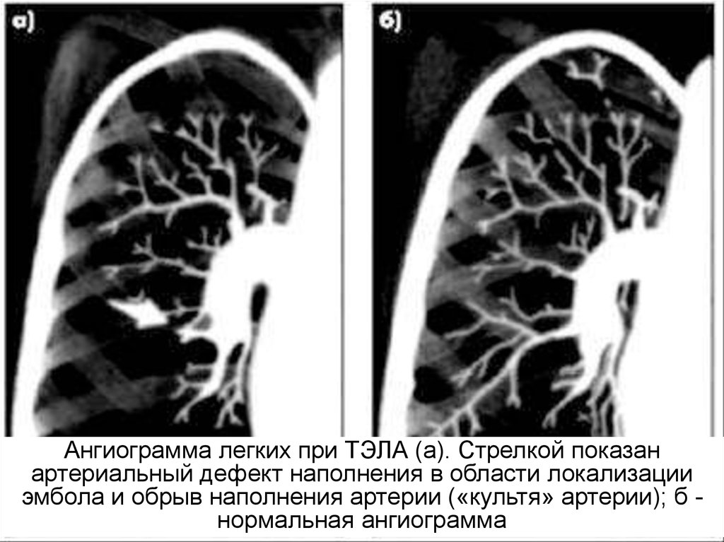 Рентген картина тэла