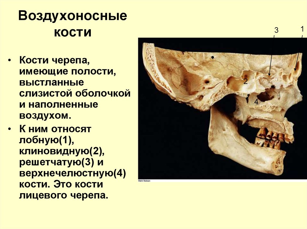 Костной полости. Воздухоносные кости черепа строение. Воздухоносные пазухи костей черепа. Пневматические воздухоносные кости черепа. Воздухоносные полости костей черепа.