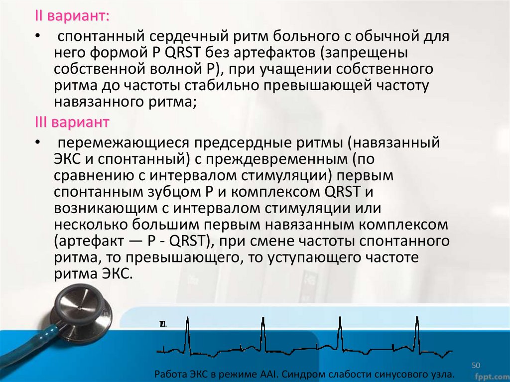 Режимы работы экс. Экс деманд режим. Режим demand кардиостимулятор. Режимы электрокардиостимуляции.